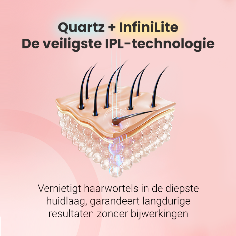 IPL foto-epilator 